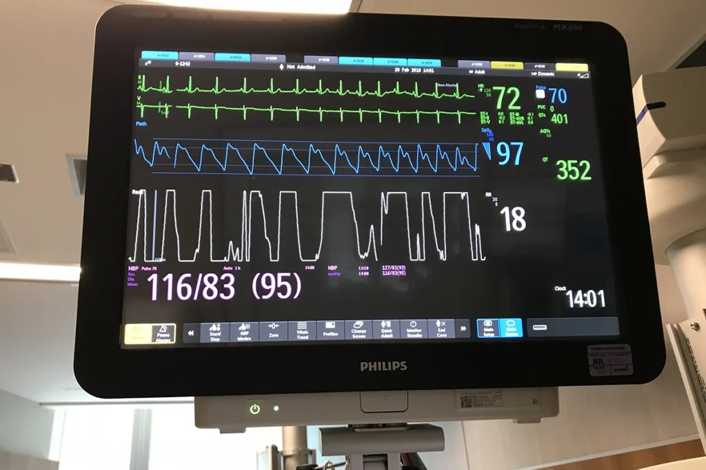 icu-equipment_Monitor